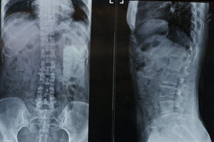 lower back pain causes
